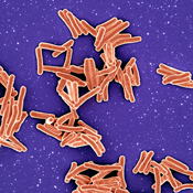 A cluster of overlapping orange rod shapes on a purple background.