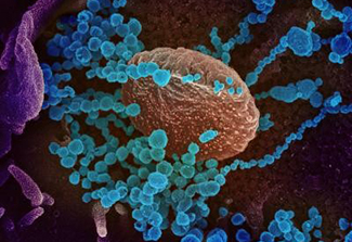 SARS-CoV-2 (round blue objects) emerges from the surface of cells the virus depicted here was isolated from a patient in the U.S.