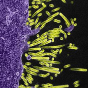 Swine flu virus particles (green) attach to and bud from the surface of a cell (purple)