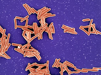 A cluster of overlapping orange rod shapes on a purple background.