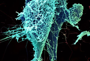 An electron microscopic view of Ebola virus particles, from NIAID