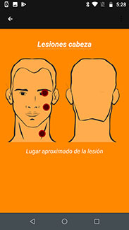 Screenshot of app to evaluate suspected leishmaniasis lesions shows back and front of face with three red indictors.
